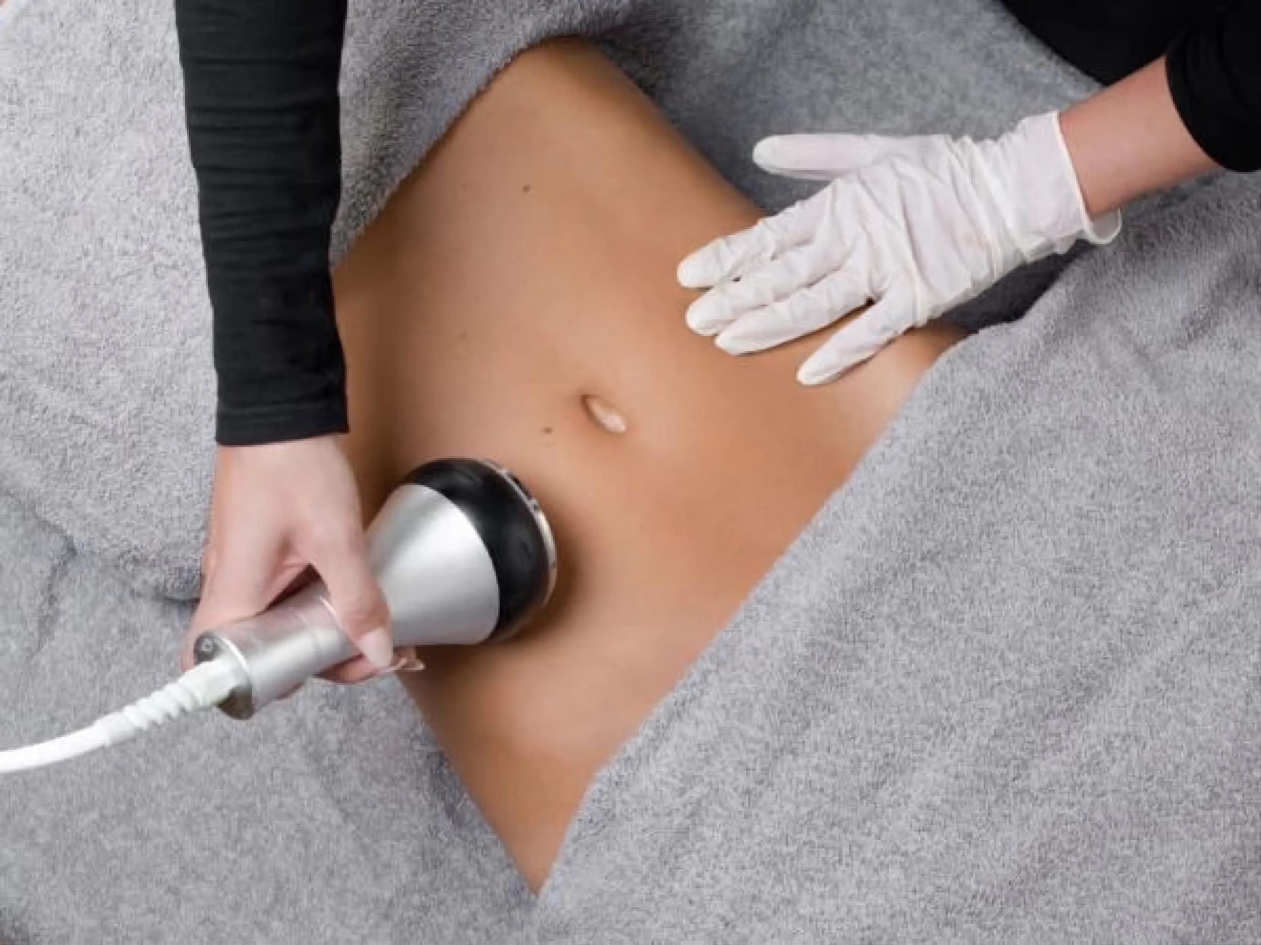 Quelle est la différence entre lipocavitation et radiofréquence ?